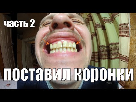 Видео: Зубные протезы (часть 2) Одели коронки из металлокерамики. Реальная история