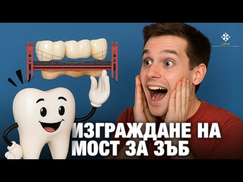 Видео: 🤍 (с субтитрами) Как сделать мост на зуб? - Стоматологическая клиника Lema