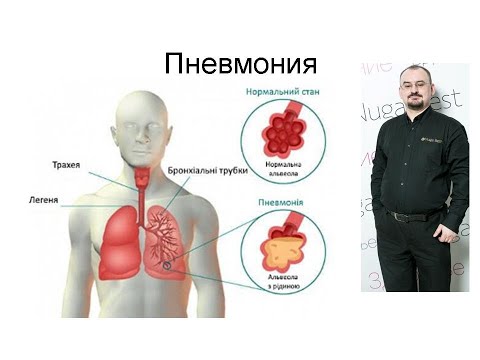 Видео: Пневмония и пульмонит - их проявления.