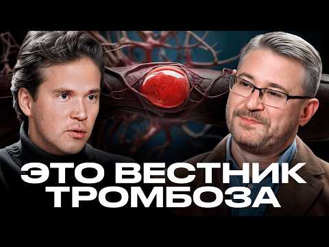 Видео: Как лечить ВАРИКОЗ на ногах и сосудистые сетки? Причины, симптомы и лечение. Острая тема.