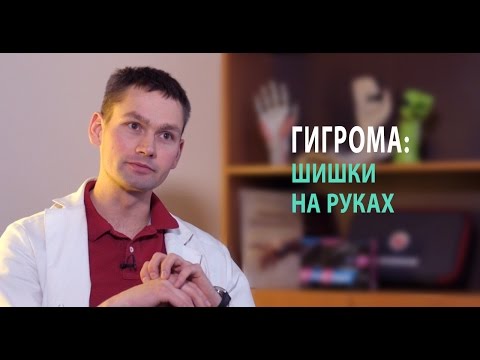 Видео: Лечение гигромы на запястье: почему шишки на запястье + какое лечение гигромы на запястье ЛУЧШЕ