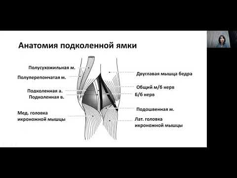 Видео: Киста Бейкера Турдакина И.Н.