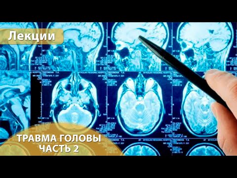 Видео: Часть 2. Компьютерная томография при травме головы. Андрей Мангов