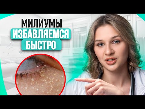 Видео: Просянки на коже – в чем их причина? / Как избавиться от белых точек на лице?