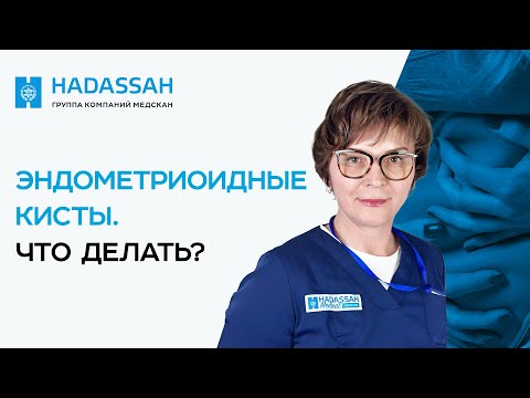Видео: Что такое ЭНДОМЕТРИОИДНАЯ КИСТА ЯИЧНИКА? Как лечить эндометриоз?