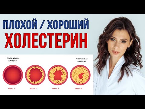 Видео: Всё про повышенный холестерин, атеросклероз, холестериновые бляшки, висцеральный жир и не только