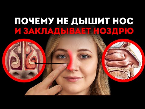 Видео: Почему Закладывает то Одну Ноздрю, то Другую?