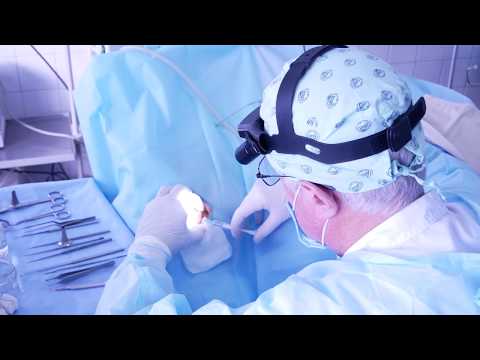 Видео: Взяття аутотрансплантату для тімпанопластики з приводу хронічного середнього отиту