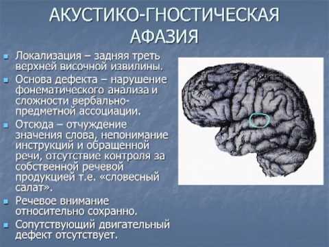 Видео: Афазия диагностика и лечение  Ekaterina Drozdova