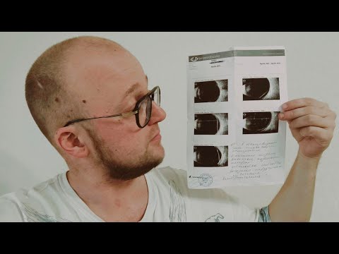 Видео: Наблюдаюсь у Хирурга в Офтальмологии, Отслоилась Сетчатка Глаза, Больница Федорова