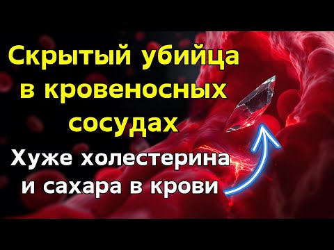 Видео: Худший яд в вашей крови! Опаснее жира и сахара в крови, но игнорируется!