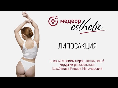 Видео: Липосакция I MEDEOR Esthetic