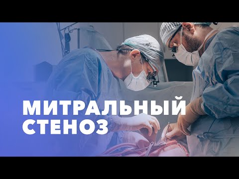 Видео: Митральный стеноз: причины, симптомы. Диагностика и лечение митрального стеноза, профилактика