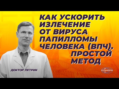 Видео: Как ускорить излечение от вируса папилломы человека ( ВПЧ). Простой метод.