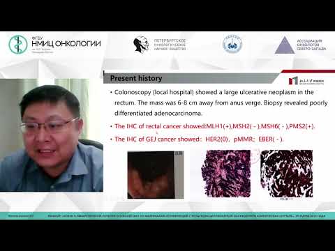 Видео: Опухоли желудочно-кишечного тракта с микросателлитной нестабильностью (Xicheng Wang)