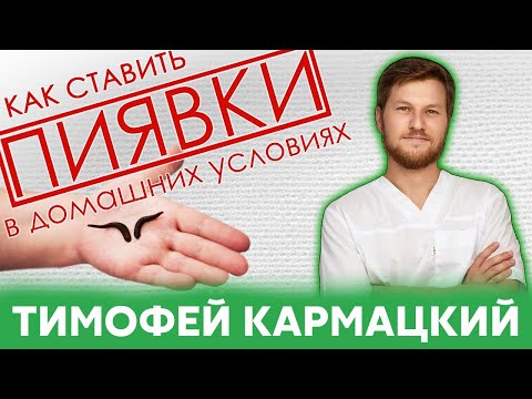 Видео: ПИЯВКИ. КАК СТАВИТЬ в домашних условиях? Тимофей Кармацкий