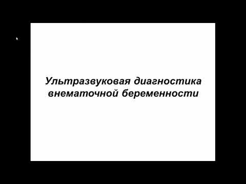 Видео: Ультразвуковая диагностика внематочной беременности