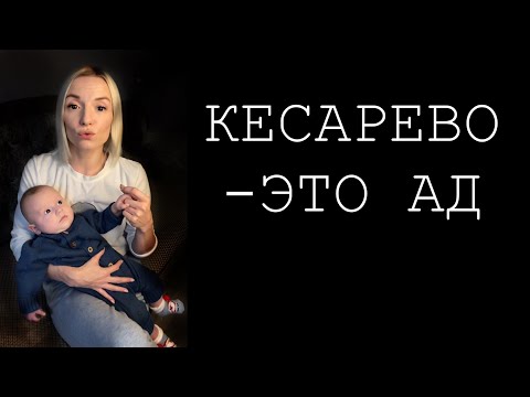 Видео: КЕСАРЕВО СЕЧЕНИЕ / показания / боли / 3 роддом Минск