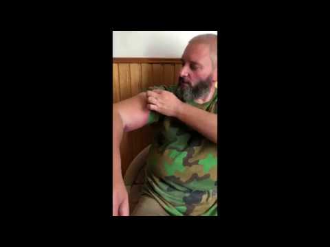 Видео: Как Вишневского гадюка укусила