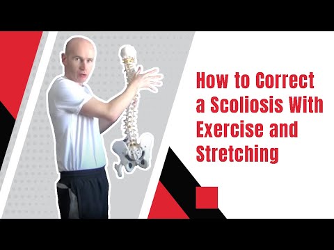 Видео: Как исправить сколиоз с помощью упражнений и растяжки | Эд Пэджет