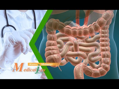 Видео: Энтероколит. Причины, симптомы, диагностика и лечение энтероколита