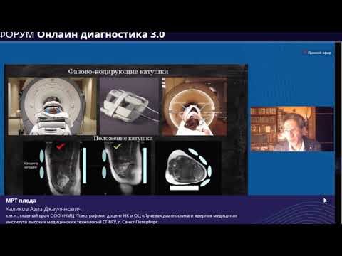 Видео: МРТ плода и плаценты