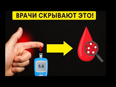 Видео: ВРАЧ РОМАНЦОВА: ПРО ДИАБЕТ МОЖНО ЗАБЫТЬ, ЕСЛИ УЗНАТЬ ОБ ЭТОМ МЕТОДЕ 💉🩺✨