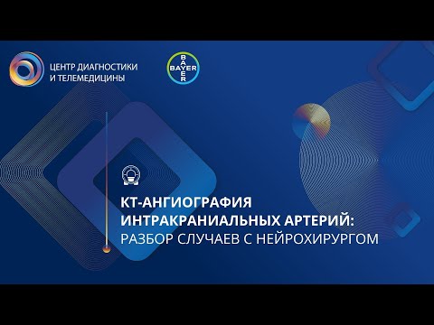 Видео: КТ-ангиография интракраниальных артерий: разбор случаев с нейрохирургом