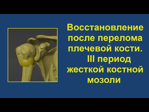 Видео: 3. Восстановление после перелома верхней трети плечевой кости. Период жесткой костной мозоли.