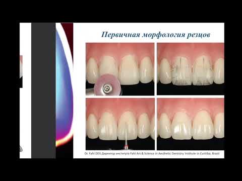 Видео: Типичные ошибки прямой композитной реставрации. Мендоса Е. Ю. Кафедра клинической стоматологии МГМСУ