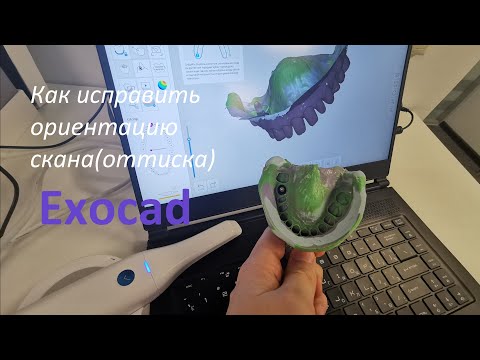 Видео: Как исправить ориентацию скана(оттиска) в Exocad