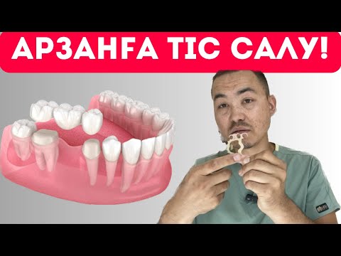 Видео: Тісіңіз болмаса не істеуге болады! Қандай вариянттар бар! #стоматология