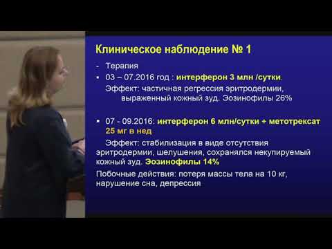 Видео: Кочкарева Ю.Б., Разбор клинических случаев кожных Т-клеточных лимфом. Определение ..
