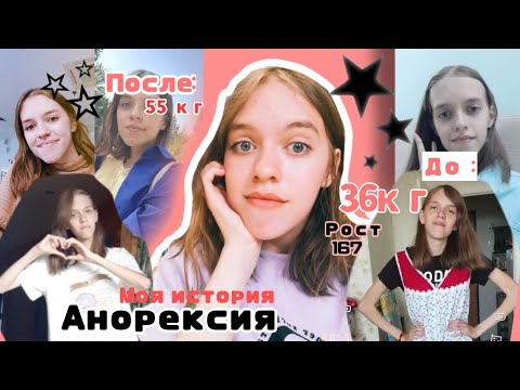 Видео: РПП МОЯ ИСТОРИЯ | как я ПОХУДЕЛА до 36кг и набрала 20кг | АНОРЕКСИЯ | РПП| Как выйти в РЕМИССИЮ