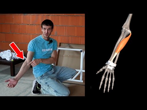 Видео: Я Победил Медиальный Эпикондилит #БелыйКапюшон #белыйкапюшонотвечает