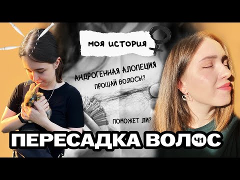 Видео: Женская пересадка волос. Андрогенная алопеция. Видео ДО пересадки.