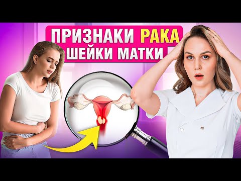 Видео: Неочевидные признаки РАКА шейки матки. Как не упустить!