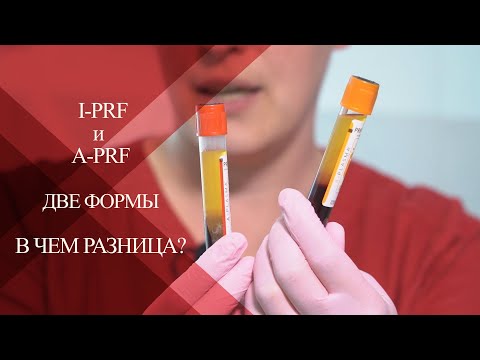 Видео: 💉Как получить IPRF и APRF| Показания к применению жидкой формы фибрина| НЮАНСЫ