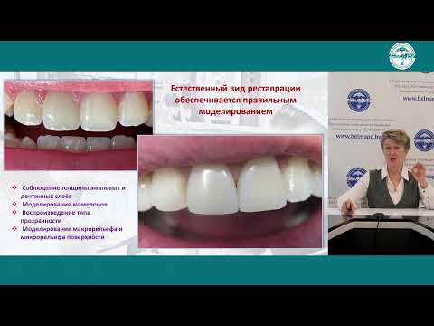 Видео: Мастер-класс «Ошибки и осложнения при работе с фотополимерными материалами» в режиме online