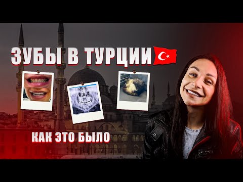 Видео: ЗУБЫ В ТУРЦИИ | Мой опыт, плюсы и минусы