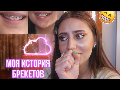 Видео: МНЕ СНЯЛИ БРЕКЕТЫ//до/после+ответы на вопросы