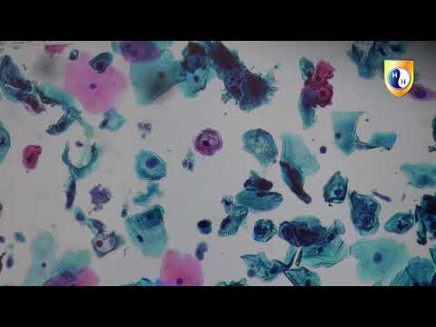 Видео: Койлоциты. Цитологический практикум.
