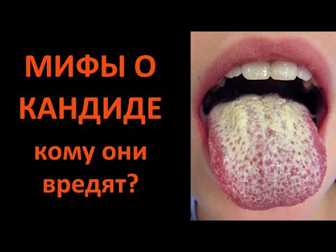 Видео: Мифы о кандиде: кому они выгодны? Научный разбор