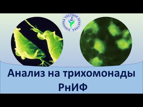 Видео: Анализ на трихомониаз РнИФ