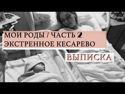 Видео: моя история родов | кесарево сечение | роды в ирландии