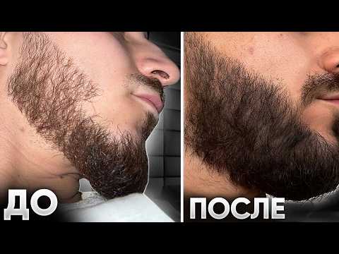 Видео: Увеличил густоту бороды и зарастил коннекторы / Результаты mr.Volos