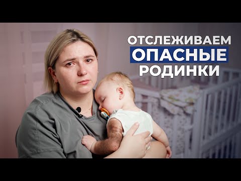 Видео: ПИГМЕНТНЫЙ НЕВУС | История Дениса Кодри