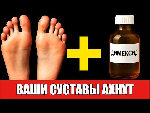 Видео: ДИМЕКСИД на стопы ЛЕЧИТ даже АРТРИТ