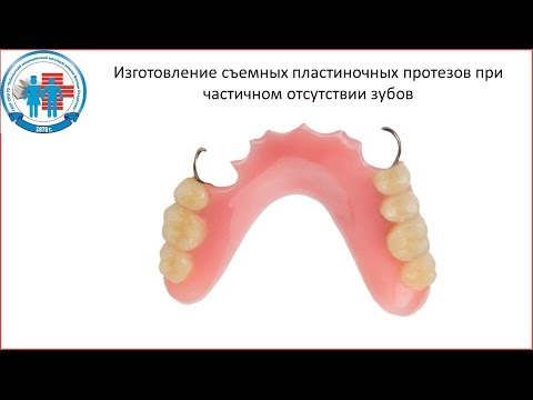 Видео: Изготовление съемных пластиночных протезов при час