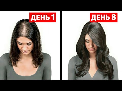Видео: КАК ОСТАНОВИТЬ ВЫПАДЕНИЕ ВОЛОС? НАТУРАЛЬНЫЕ ДОМАШНИЕ МАСКИ
